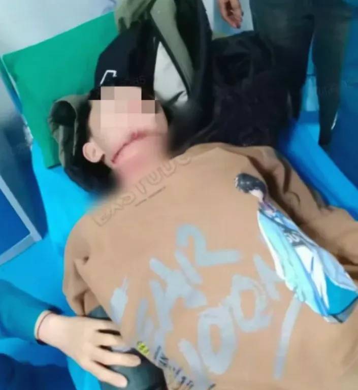 皇冠代理登录地址_河南13岁被锁喉男孩赴京治疗后已脱离生命危险皇冠代理登录地址，拉绳老人已被采取刑事强制措施